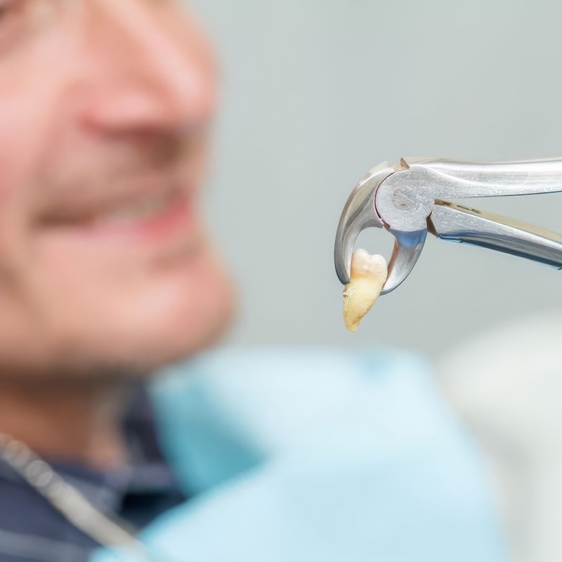 What to eat after having a tooth pulled